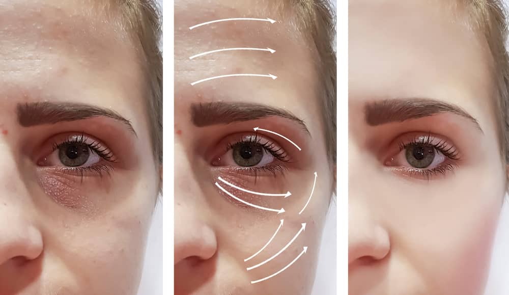 Skin Reboot: Reset Your Complexion